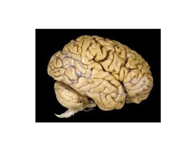 image of brain