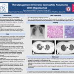 "The Management of Chronic Eosinophilic Pneumonia with Mepolizumab" Romy Lawrence, MD