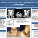 "A Case of Scrofuloderma from Mycobacterium bovis" Ryan Knodle, MD