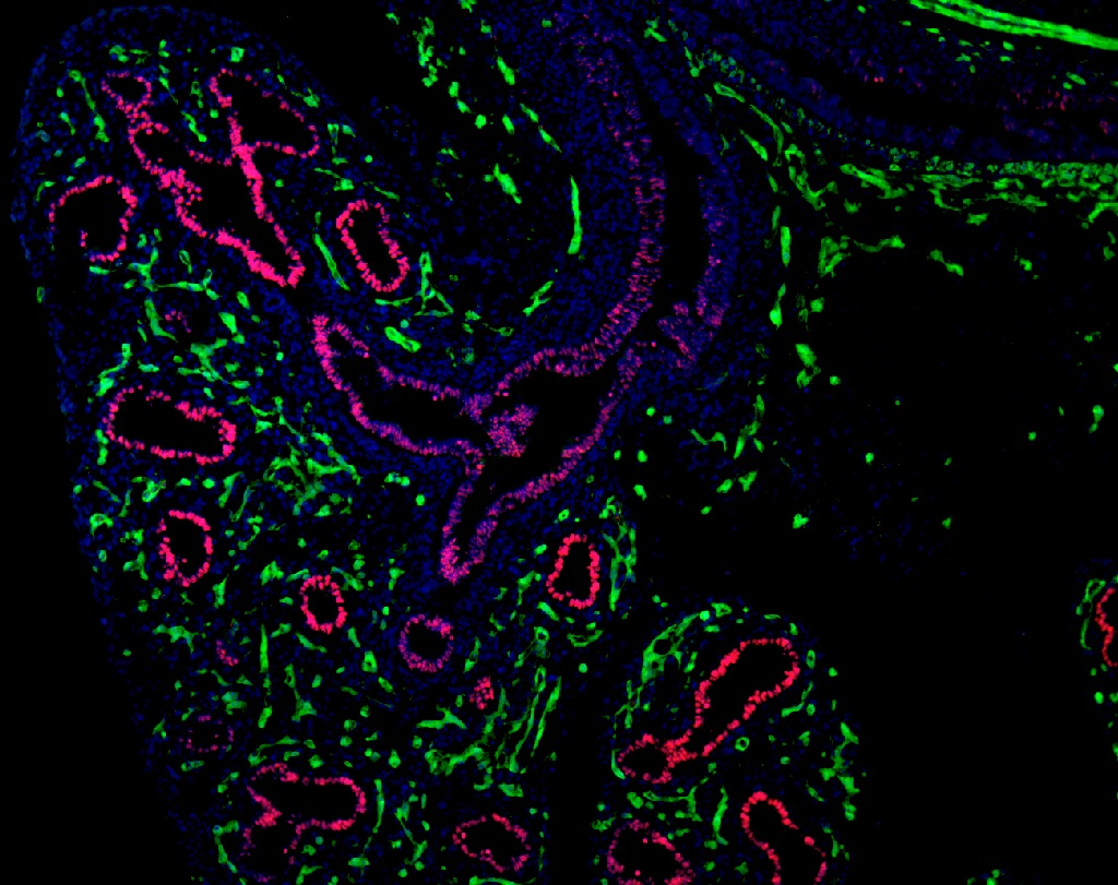 E13.5 Lung Nkx2.1Red Flk1Cre-YFP green DAPI blue