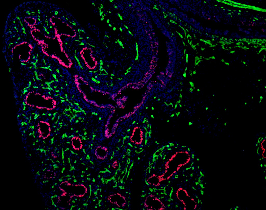 E13.5 Lung Nkx2.1Red Flk1Cre-YFP green DAPI blue