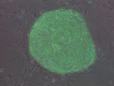 Child iPSC NKX mutant Tra1-81 GFP Merge