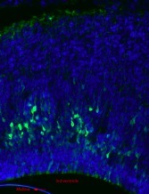 Blue highlighted brain scan