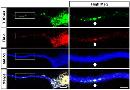 TDP and TIA Prim Neurons-sm (2)