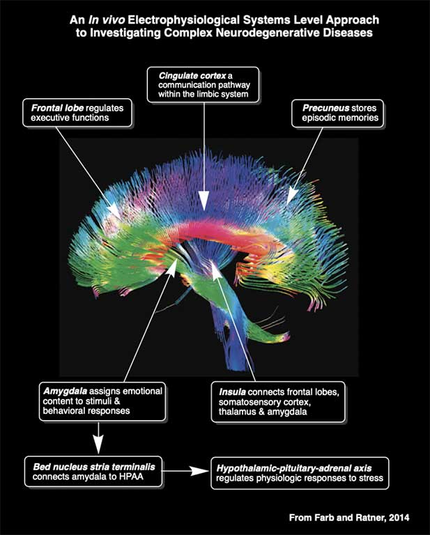 Electrophysiological Systems Diagram of a Brain