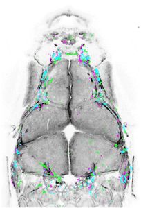 Osteoclast distribution in developing skull