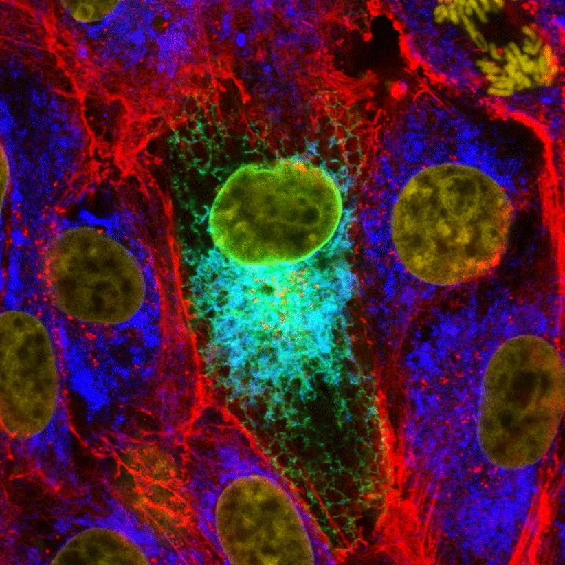 Host-Pathogen Interactions Duprex