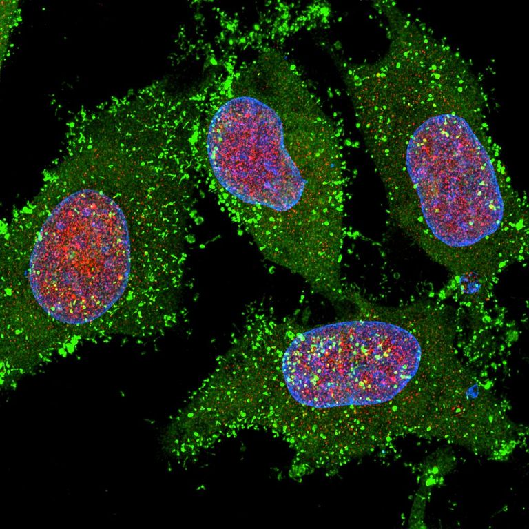 Green and Purple cells