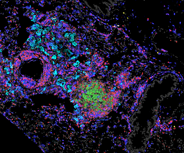 MTB Cell